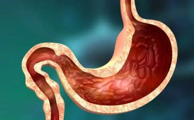 Rêver d'estomac : quelles interprétations, analyses et significations ?